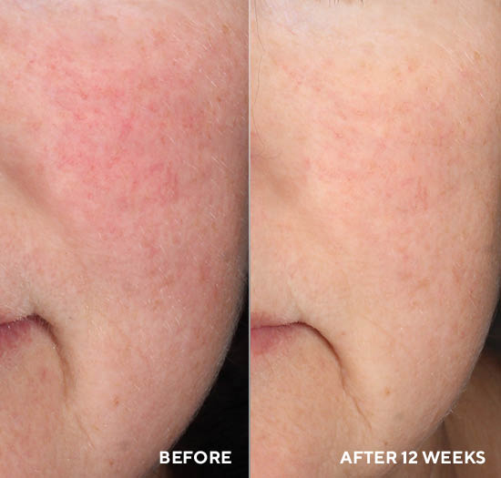 Интервью с эпигенетиком доктором Нилом Китченом о биологической добавке InnerDerm Rx | Alfaspa изображение 4